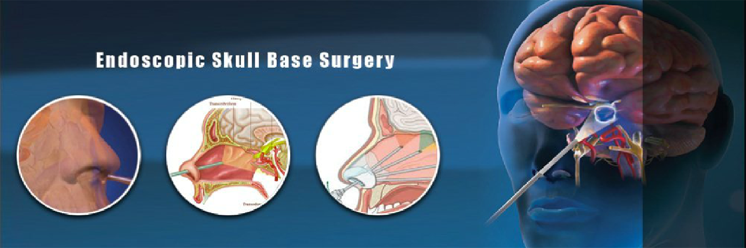 ENT Specialist Doctor In Ahmedabad